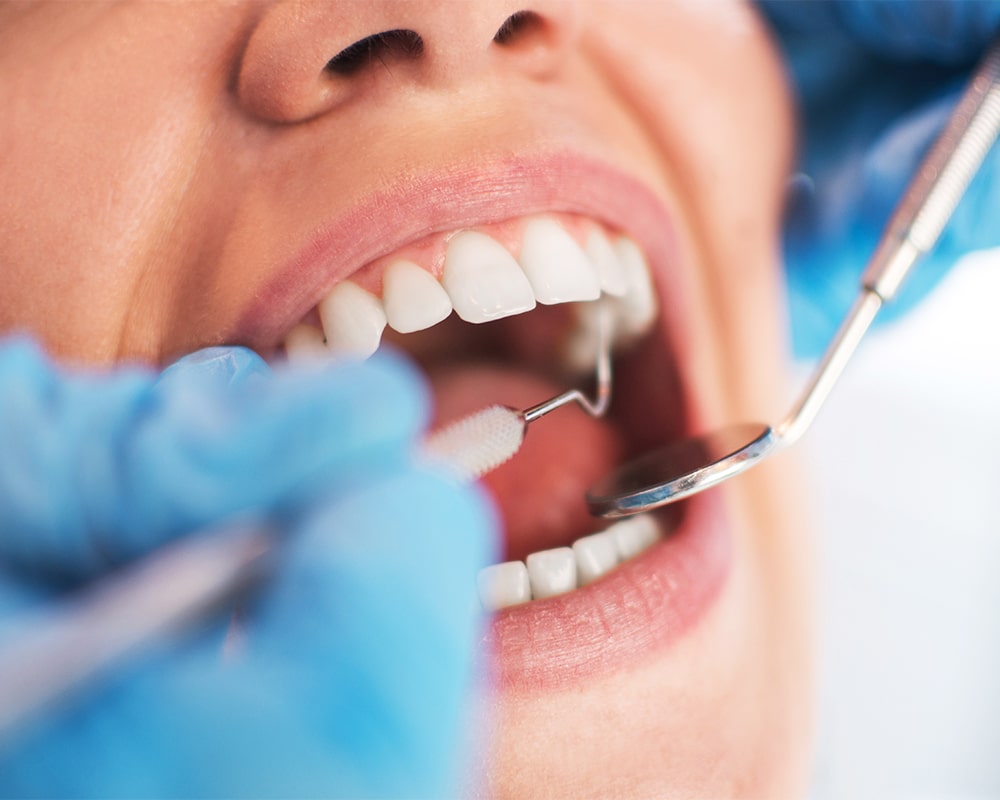 Zahnarzt Düsseldorf Endodontie